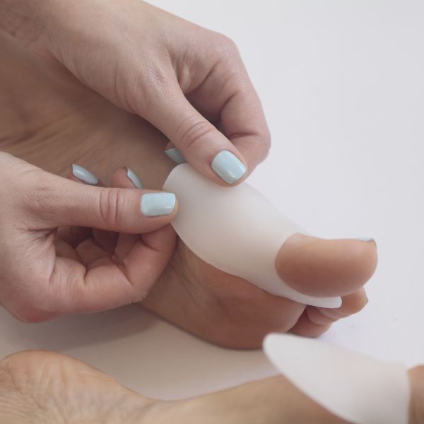 cuidados para juanetes sin cirugia