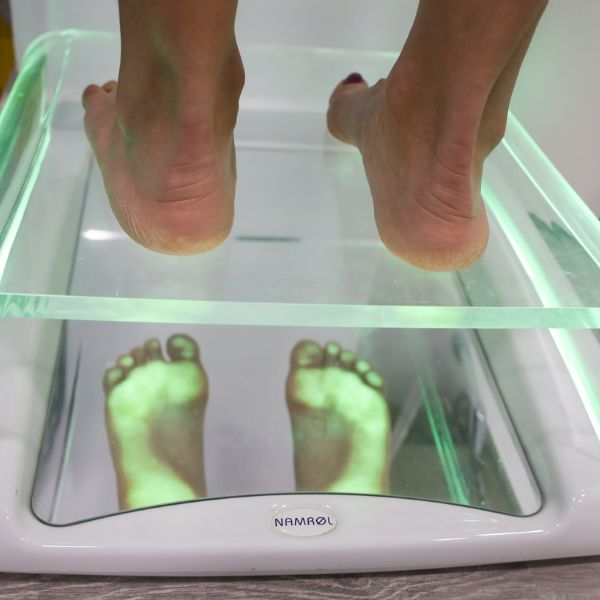 Estudio de la pisada con plataforma de presiones para analizar el apoyo plantar en pacientes con juanetes
