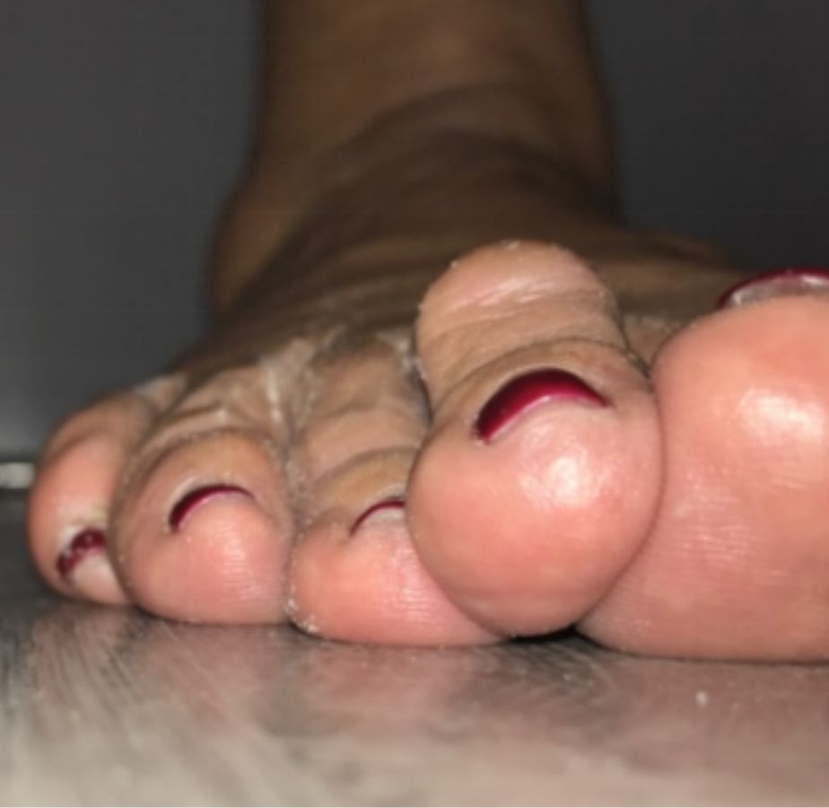 casos reales juanetes alicante (8)