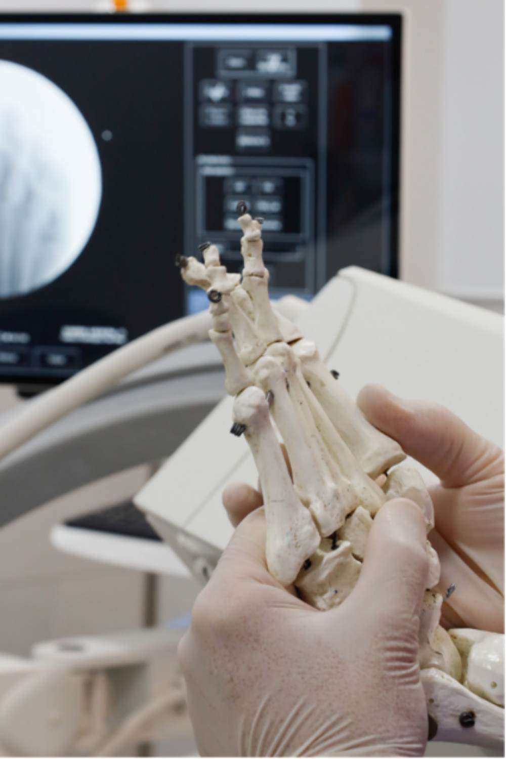 cirugía de juanetes en Alicante